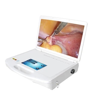 Işık kaynağı ile tıbbi HD Endoskop Kamera ünitesi KBB taşınabilir endoskopi kamera sistemi